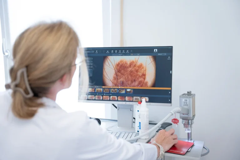 Digitale Analyse einer Hautaufnahme am Monitor